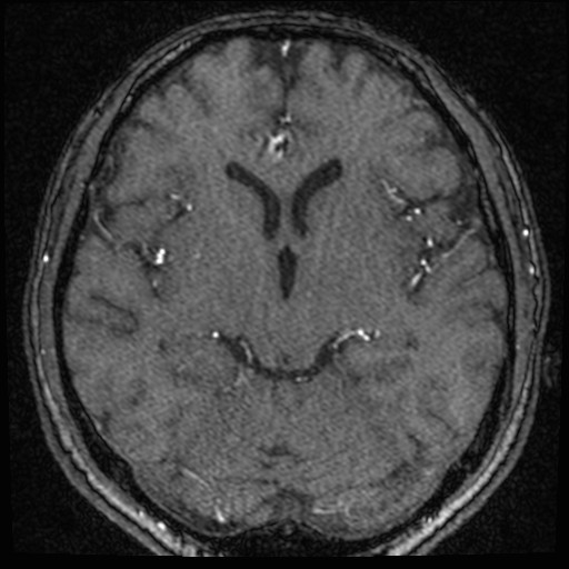 Click on the Serie image to view the images of VILLANUEVA, WILLIAM A.